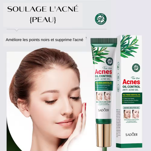 Gel Anti-Acné